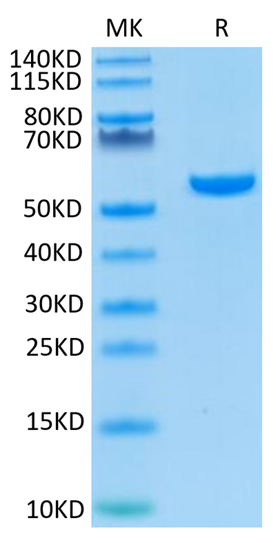 Human HLA-A*02:01&B2M&WT-1 (RMFPNAPYL) Monomer on Tris-Bis PAGE under reduced condition. The purity is greater than 95%.Recombinant Human HLA-A*02:01&B2M&WT-1 (RMFPNAPYL) Monomer Protein, Active