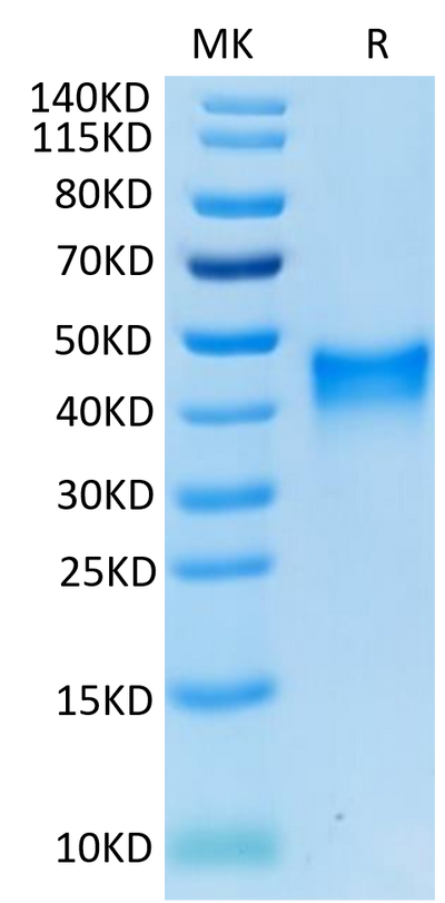 Mouse 4-1BB on Tris-Bis PAGE under reduced condition. The purity is greater than 95%.Recombinant Mouse 4-1BB/TNFRSF9 Protein, Active