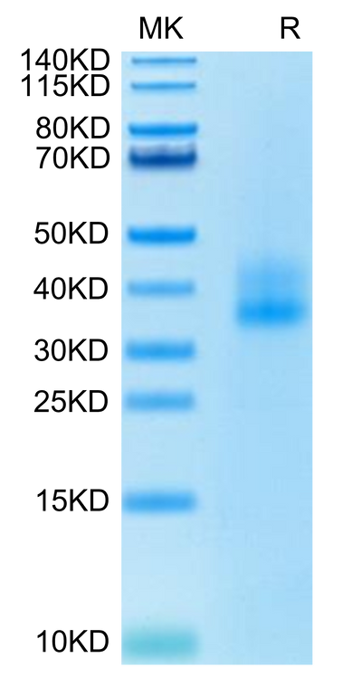Human 4-1BB on Tris-Bis PAGE under reduced condition. The purity is greater than 95%.Recombinant Human 4-1BB/TNFRSF9 Protein, Active