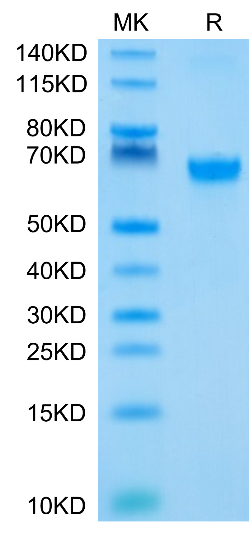 Biotinylated Human 4-1BB on Tris-Bis PAGE under reduced condition. The purity is greater than 95%.Biotinylated Human 4-1BB/TNFRSF9 Protein, Active