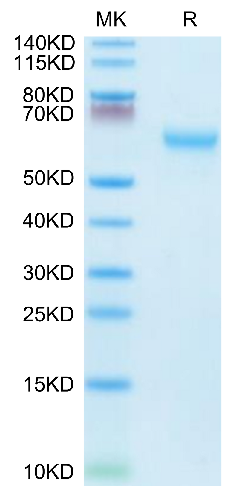 Mouse CD27 on Tris-Bis PAGE under reduced condition. The purity is greater than 95%.Recombinant Mouse CD27/TNFRSF7 Protein, Active