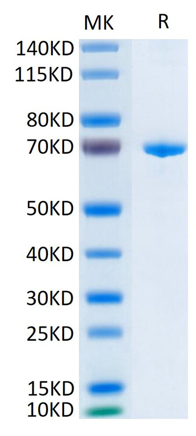 Human Her3 on Tris-Bis PAGE under reduced condition. The purity is greater than 95%.Recombinant Human Her3/ErbB3 Protein, Active
