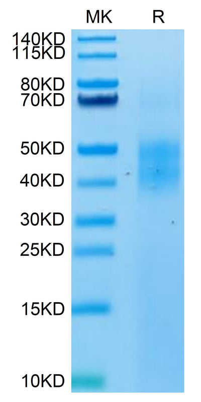 Biotinylated Human NKG2A on Tris-Bis PAGE under reduced condition. The purity is greater than 95%.Biotinylated Human NKG2A/CD159a Protein, Active