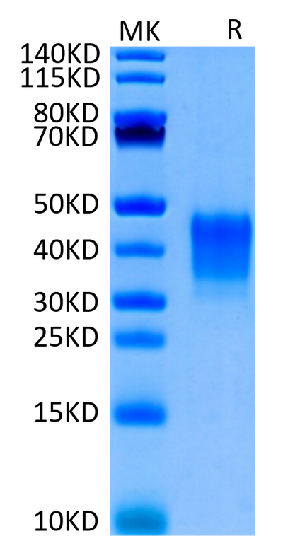 Biotinylated Human CD7 on Tris-Bis PAGE under reduced condition. The purity is greater than 95%.Biotinylated Human CD7 Protein, Active