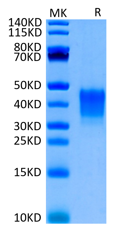 Biotinylated Human CD7 on Tris-Bis PAGE under reduced condition. The purity is greater than 95%.Biotinylated Human CD7 Protein, Active