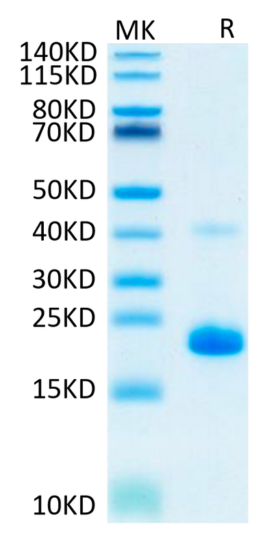 Human TNF alpha on Tris-Bis PAGE under reduced condition. The purity is greater than 95%.Recombinant Human TNF alpha Protein, Active