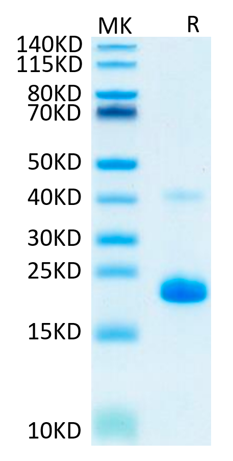 Human TNF alpha on Tris-Bis PAGE under reduced condition. The purity is greater than 95%.Recombinant Human TNF alpha Protein, Active