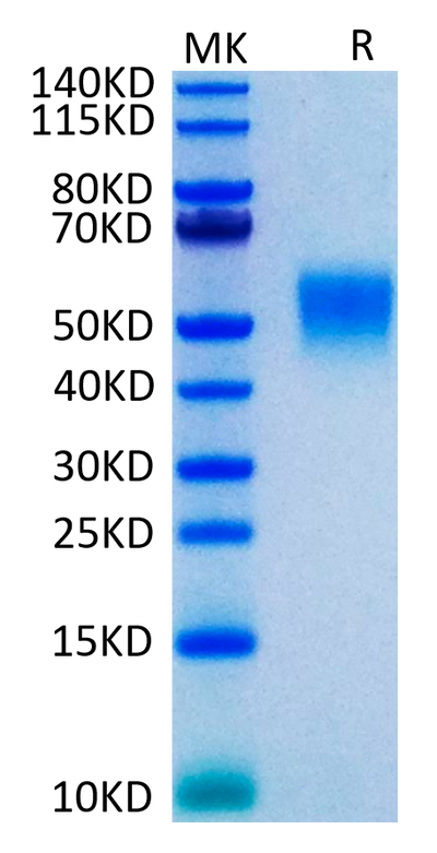 Human TNFR2 on Tris-Bis PAGE under reduced condition. The purity is greater than 95%.Recombinant Human TNFR2/CD120b/TNFRSF1B Protein, Active