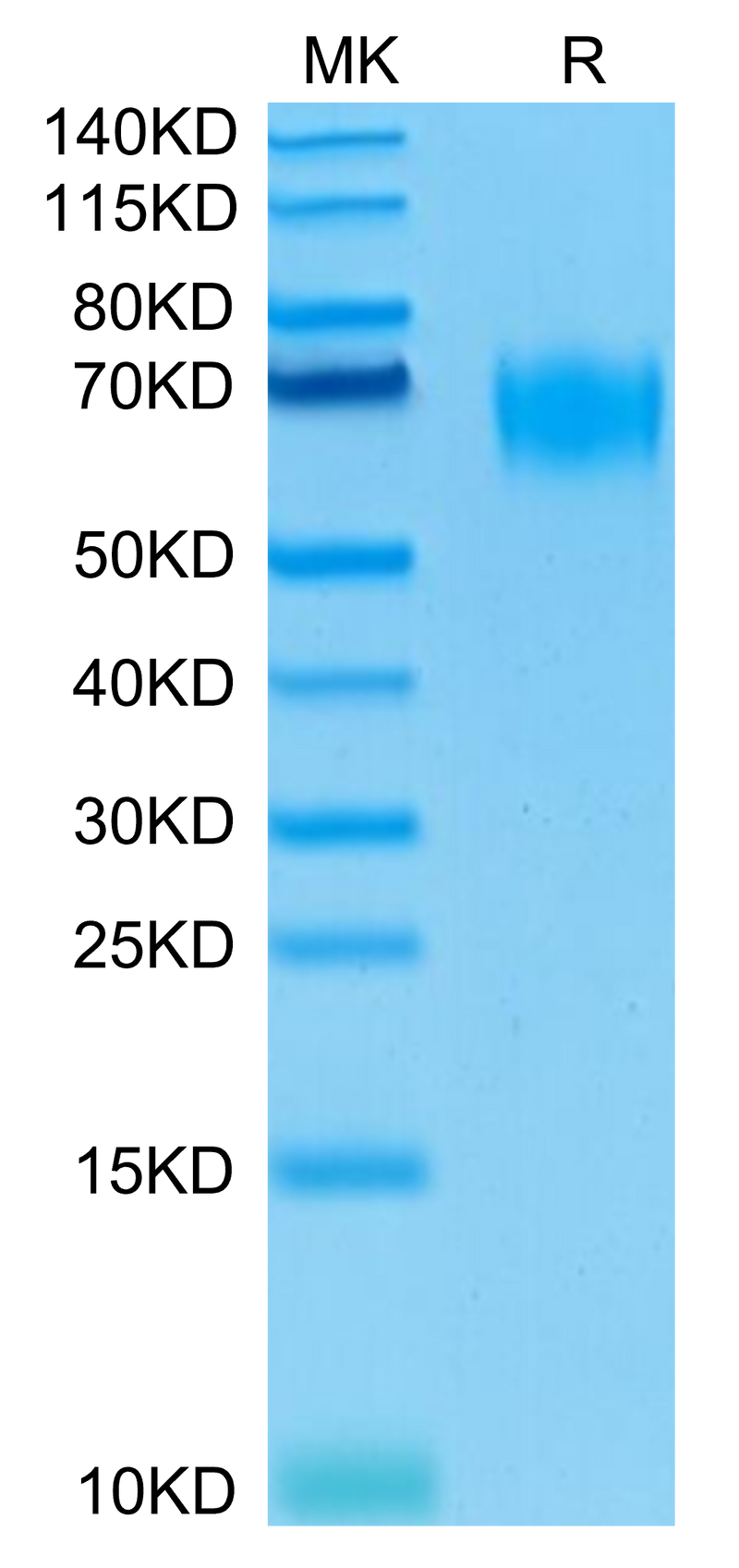 Biotinylated Human CD155 on Tris-Bis PAGE under reduced conditions. The purity is greater than 95%.Biotinylated Human CD155/PVR Protein, Active