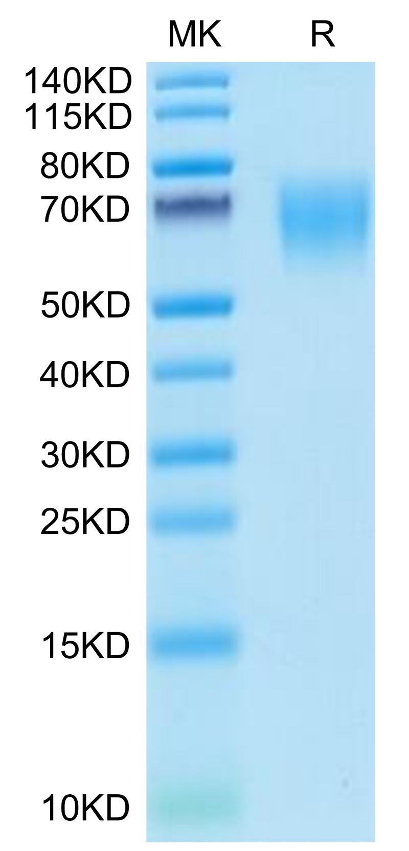 Mouse CD155 on Tris-Bis PAGE under reduced condition. The purity is greater than 95%.Recombinant Mouse CD155/PVR Protein, Active