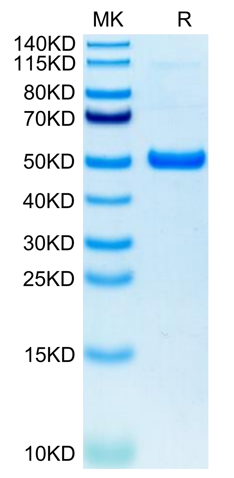 Human GITR on Tris-Bis PAGE under reduced condition. The purity is greater than 95%.Recombinant Human GITR/TNFRSF18 Protein, Active