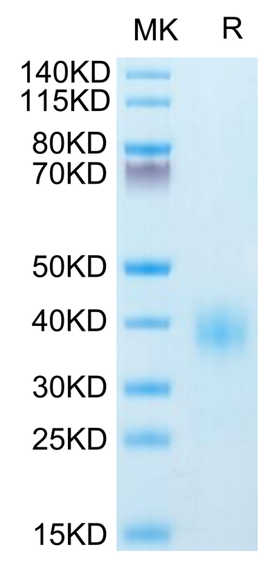Human BTLA-on Tris-Bis PAGE under reduced condition. The purity is greater than 95%.