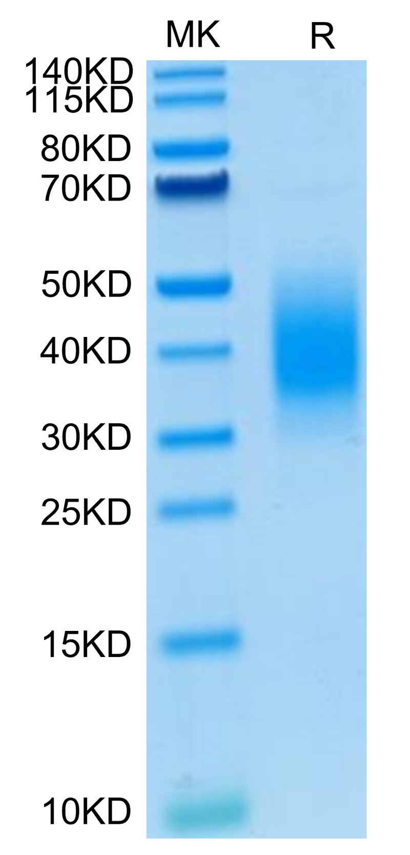 Mouse BTLA-on Tris-Bis PAGE under reduced condition. The purity is greater than 95%.Recombinant Mouse BTLA Protein