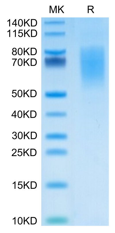 Human CA125 on Tris-Bis PAGE under reduced condition. The purity is greater than 95%.