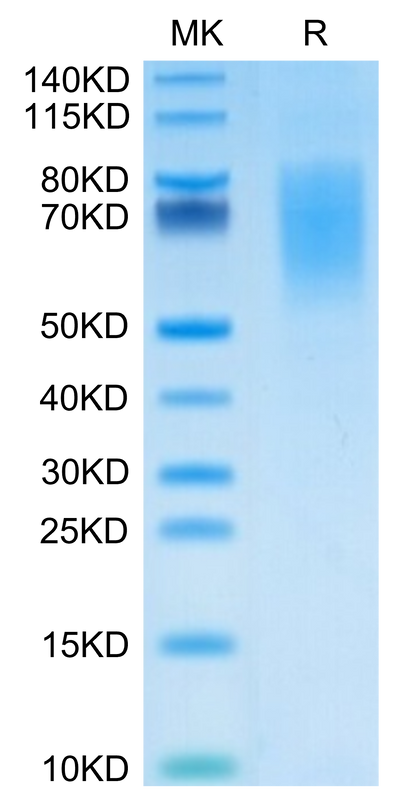Human CA125 on Tris-Bis PAGE under reduced condition. The purity is greater than 95%.Recombinant Human CA125/MUC16 Protein, Active