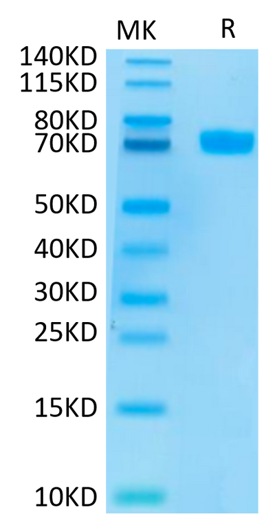 Human MSLN on Tris-Bis PAGE under reduced conditions. The purity is greater than 95%.