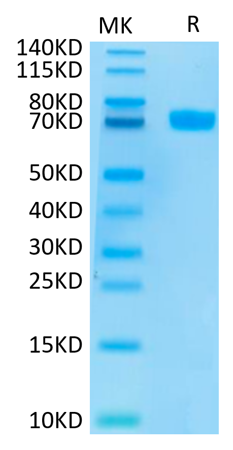 Human MSLN on Tris-Bis PAGE under reduced conditions. The purity is greater than 95%.Recombinant Human MSLN/Mesothelin Protein, Active