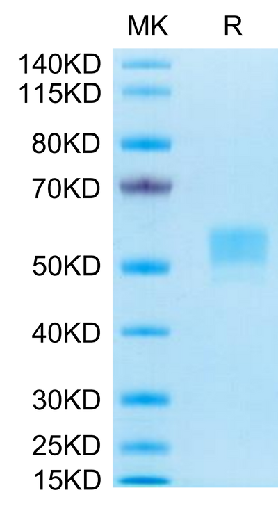 Human CD79B on Tris-Bis PAGE under reduced conditions. The purity is greater than 95%.Recombinant Human CD79B Protein, Active