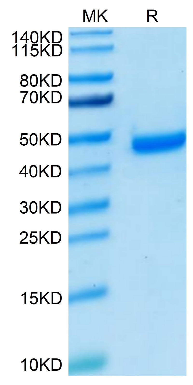 Human Nectin-4 on Tris-Bis PAGE under reduced condition. The purity is greater than 95%.Recombinant Human Nectin-4 Protein, Active