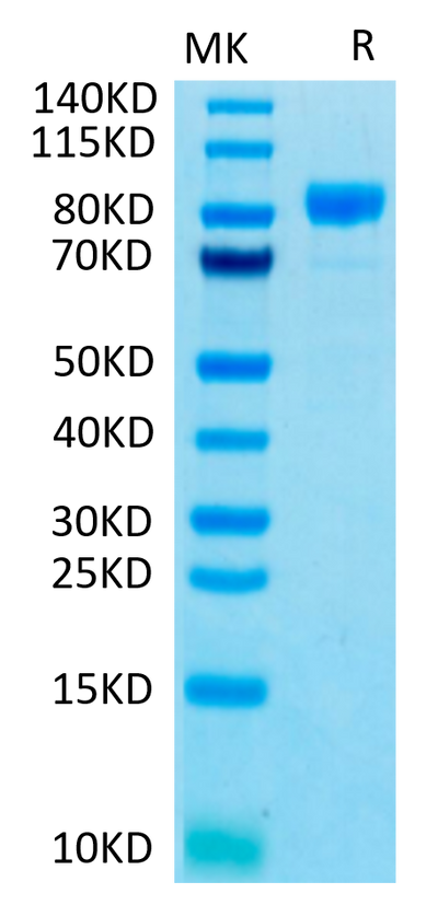 Human FGFR4 on Tris-Bis PAGE under reduced conditions. The purity is greater than 95%.Recombinant Human FGFR4 Protein, Active