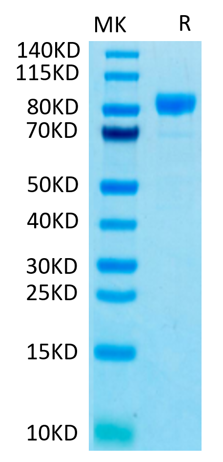 Human FGFR4 on Tris-Bis PAGE under reduced conditions. The purity is greater than 95%.Recombinant Human FGFR4 Protein, Active