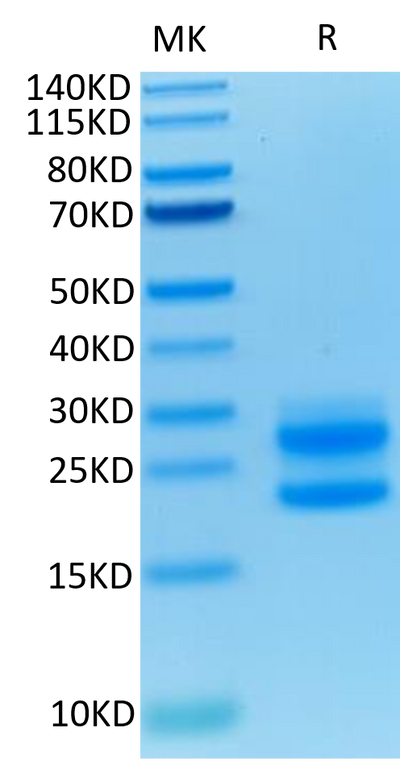 Mouse IL-17A on Tris-Bis PAGE under reduced condition. The purity is greater than 95%.Recombinant Mouse IL-17A/CTLA-8 Protein, Active