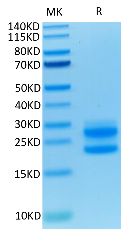 Mouse IL-17A on Tris-Bis PAGE under reduced condition. The purity is greater than 95%.Recombinant Mouse IL-17A/CTLA-8 Protein, Active