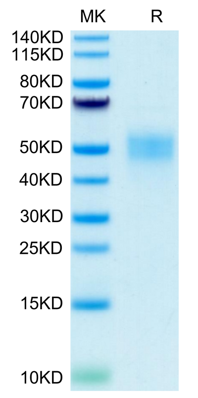 Human Fc gamma RIIIB (NA2) on Tris-Bis PAGE under reduced condition. The purity is greater than 95%.Recombinant Human Fc gamma RIIIB/CD16b (NA2) Protein, Active