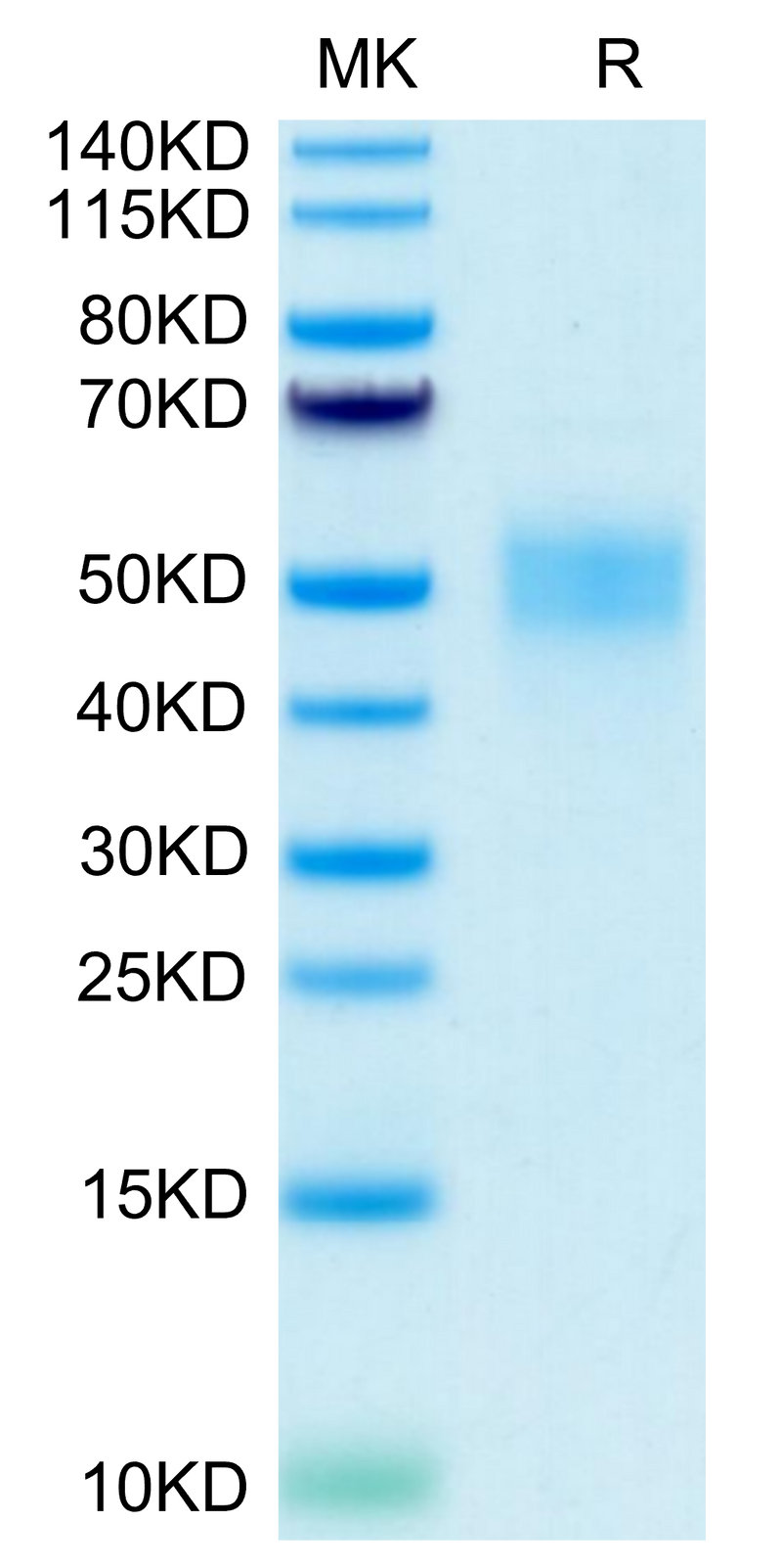 Human Fc gamma RIIIB (NA2) on Tris-Bis PAGE under reduced condition. The purity is greater than 95%.Recombinant Human Fc gamma RIIIB/CD16b (NA2) Protein, Active