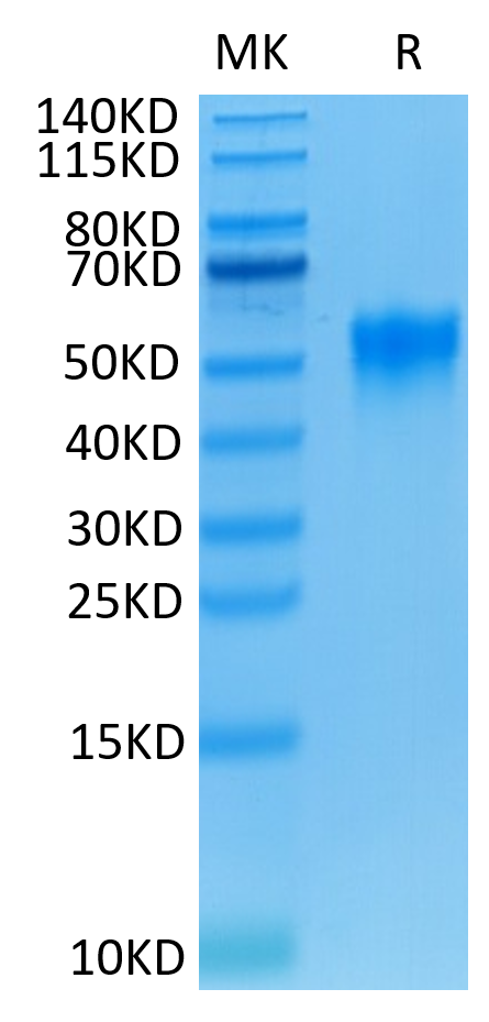 Human Fc gamma RIIIA (F176) on Tris-Bis PAGE under reduced conditions. The purity is greater than 95%.