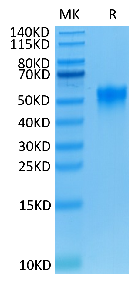 Human Fc gamma RIIIA (F176) on Tris-Bis PAGE under reduced conditions. The purity is greater than 95%.Recombinant Human Fc gamma RIIIA/CD16a (F176) Protein, Active