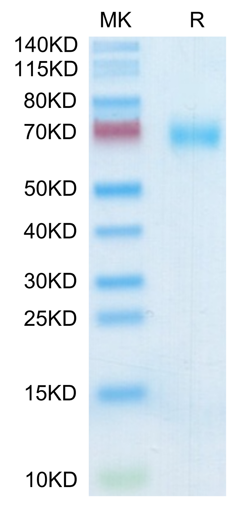 Human SLAMF7 on Tris-Bis PAGE under reduced condition. The purity is greater than 95%.Recombinant Human SLAMF7/CRACC/CD319 Protein, Active
