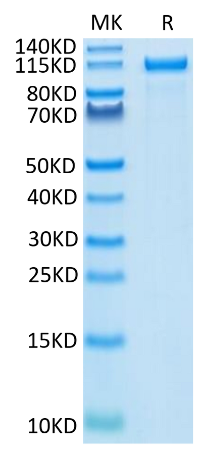 Human Her2 on Tris-Bis PAGE under reduced condition. The purity is greater than 95%.Recombinant Human Her2/ErbB2 Protein, Active