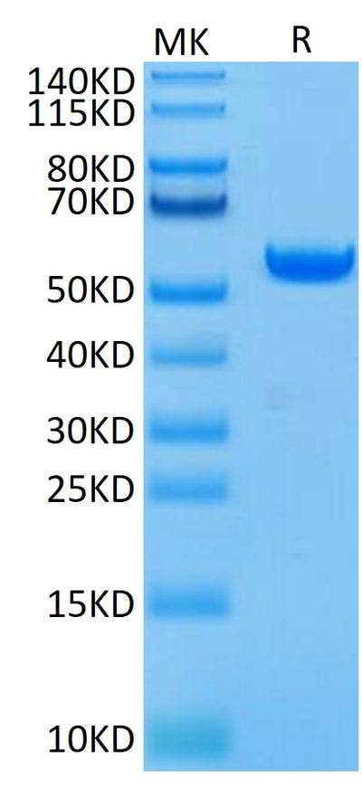 Biotinylated Human HLA-A*02:01&B2M&GP100 (YLEPGPVTA) Monomer on Tris-Bis PAGE under reduced condition. The purity is greater than 95%.Biotinylated Human HLA-A*02:01&B2M&GP100 (YLEPGPVTA) Monomer Protein, Active