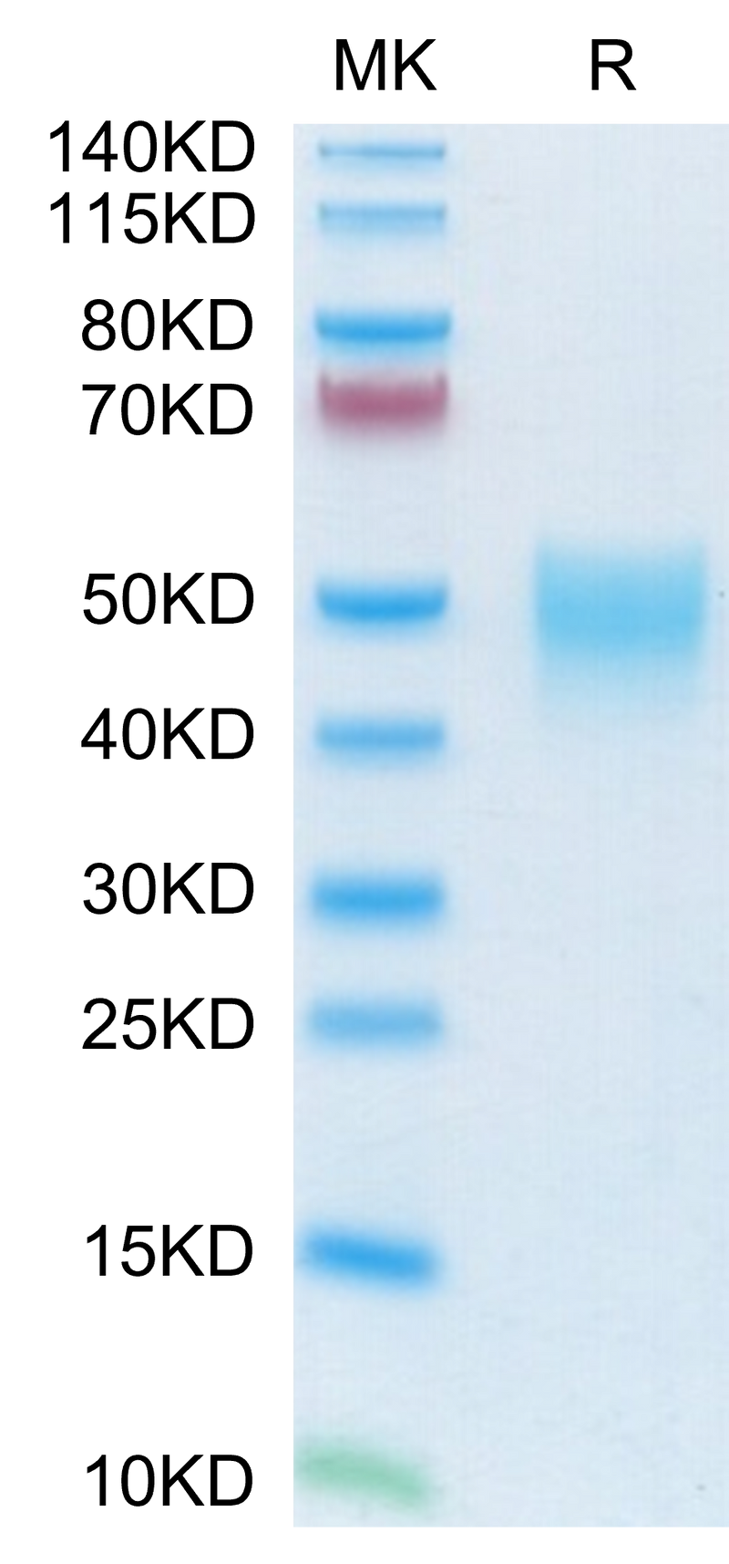Mouse NKp46 on Tris-Bis PAGE under reduced condition. The purity is greater than 95%.Recombinant Mouse NKp46/NCR1/CD335 Protein