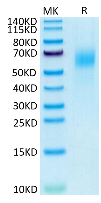 Human IL-13Ra1 on Tris-Bis PAGE under reduced condition. The purity is greater than 95%.Recombinant Human IL-13Ra1 Protein, Active