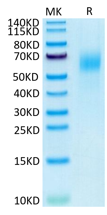 Human IL-13Ra1 on Tris-Bis PAGE under reduced condition. The purity is greater than 95%.Recombinant Human IL-13Ra1 Protein, Active