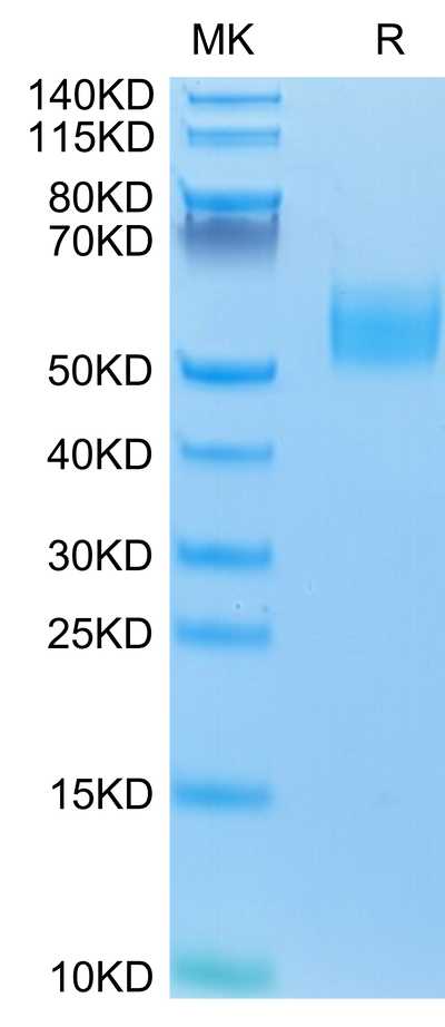 Mouse IL-13Ra1 on Tris-Bis PAGE under reduced conditions. The purity is greater than 95%.Recombinant Mouse IL-13Ra1 Protein