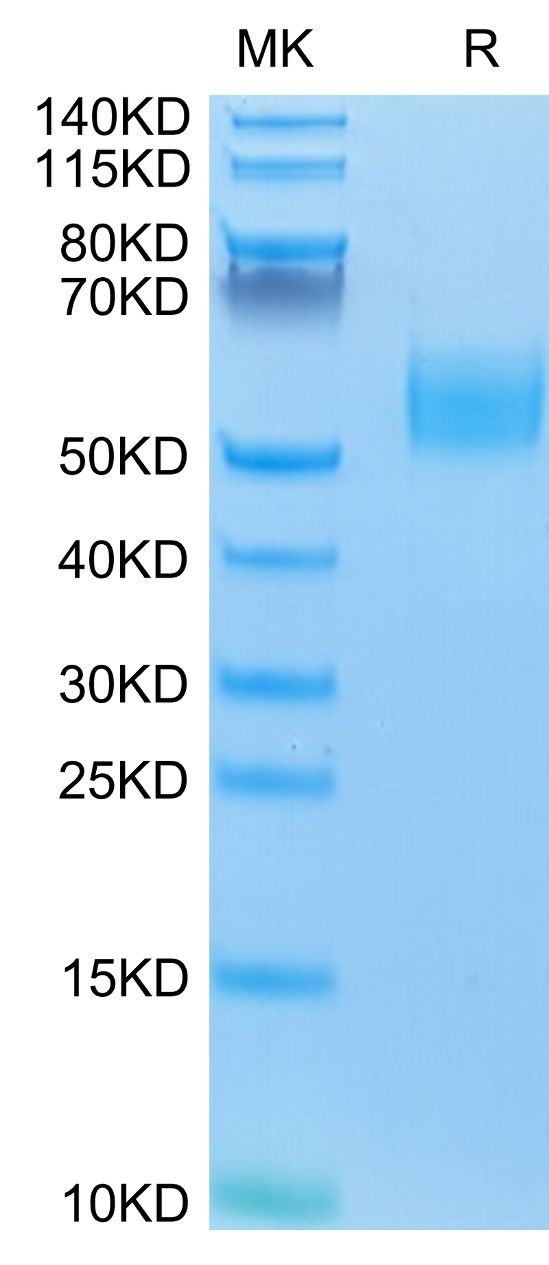 Mouse IL-13Ra1 on Tris-Bis PAGE under reduced conditions. The purity is greater than 95%.Recombinant Mouse IL-13Ra1 Protein