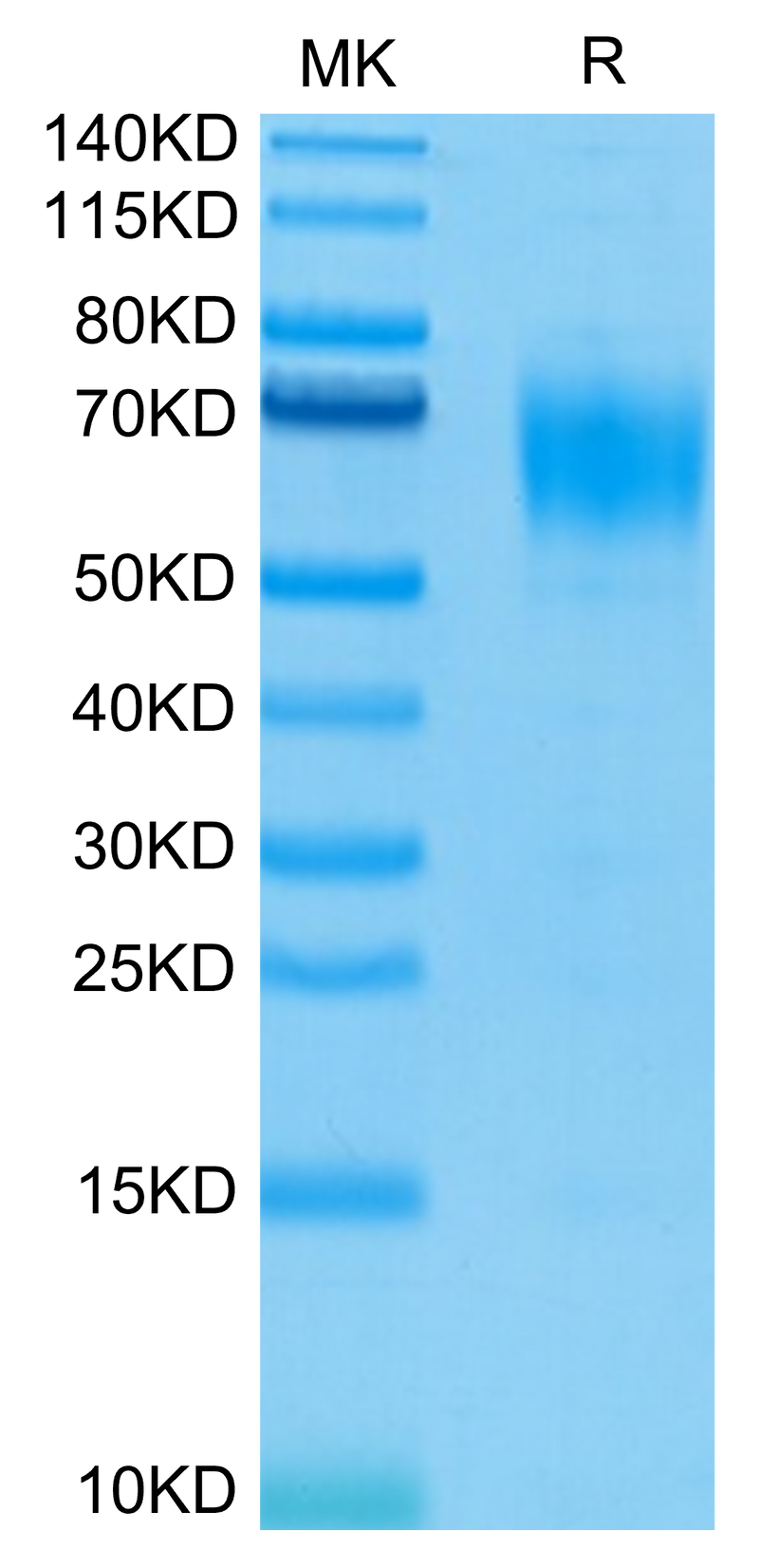 Biotinylated Human IL-13Ra1 on Tris-Bis PAGE under reduced condition. The purity is greater than 95%.Biotinylated Human IL-13Ra1 Protein, Active