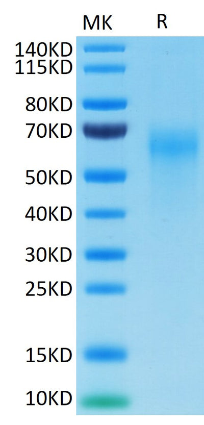 Cynomolgus IL-2 R gamma on Tris-Bis PAGE under reduced conditions. The purity is greater than 95%.Recombinant Cynomolgus IL-2 R gamma/CD132 Protein