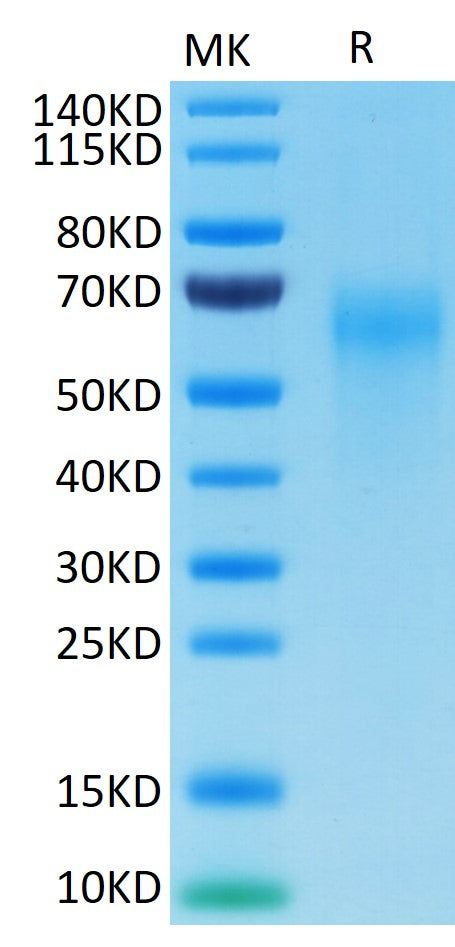 Cynomolgus IL-2 R gamma on Tris-Bis PAGE under reduced conditions. The purity is greater than 95%.Recombinant Cynomolgus IL-2 R gamma/CD132 Protein
