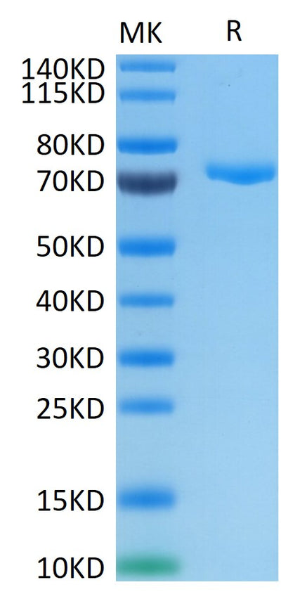 Human Nectin-4 on Tris-Bis PAGE under reduced conditions. The purity is greater than 95%.