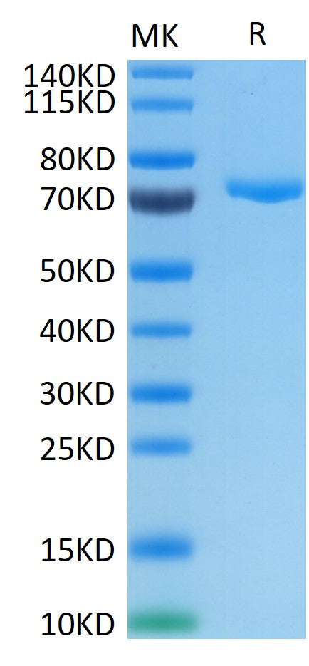 Human Nectin-4 on Tris-Bis PAGE under reduced conditions. The purity is greater than 95%.Recombinant Human Nectin-4 Protein, Active