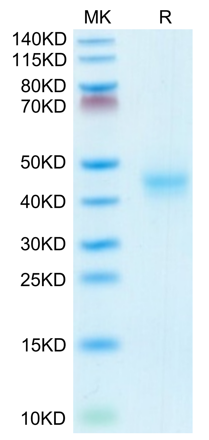 Mouse CD52 on Tris-Bis PAGE under reduced conditions. The purity is greater than 95%.Recombinant Mouse CD52 Protein