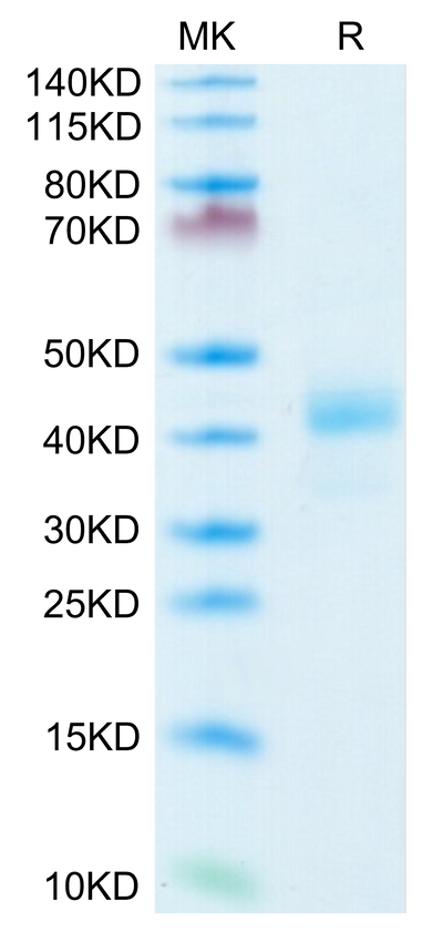 Human CD52 on Tris-Bis PAGE under reduced condition. The purity is greater than 95%.Recombinant Human CD52 Protein
