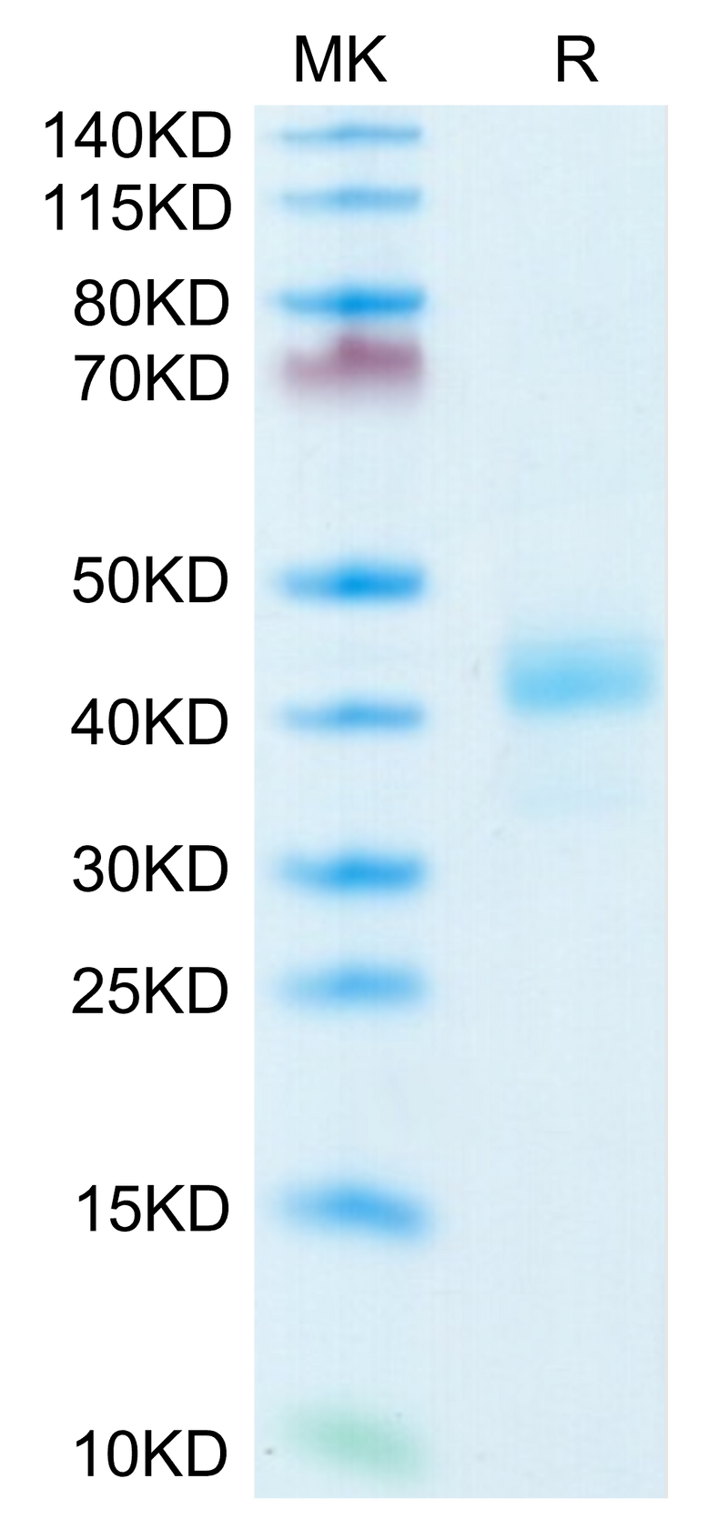 Human CD52 on Tris-Bis PAGE under reduced condition. The purity is greater than 95%.Recombinant Human CD52 Protein