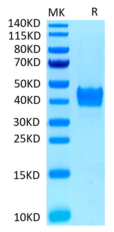 Human CD52 on Tris-Bis PAGE under reduced conditions. The purity is greater than 95%.Recombinant Human CD52 Protein