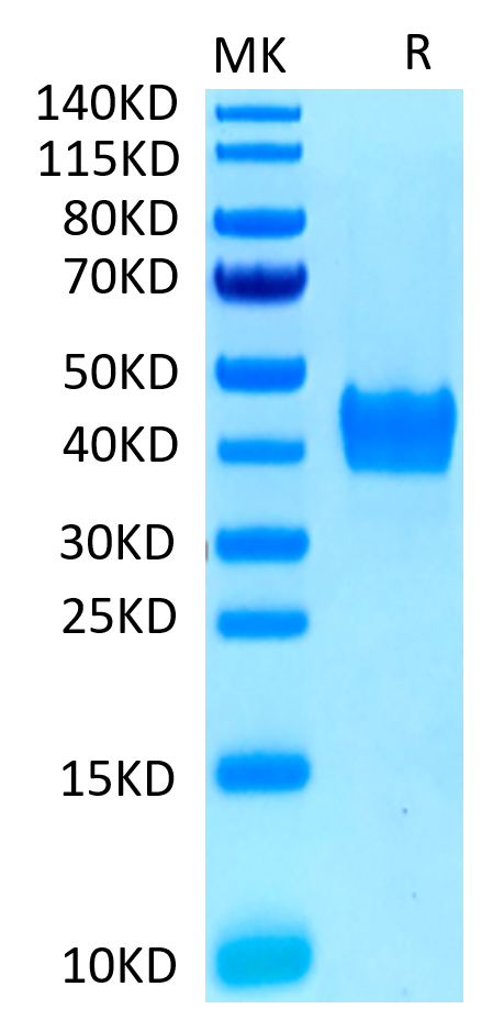 Human CD52 on Tris-Bis PAGE under reduced conditions. The purity is greater than 95%.Recombinant Human CD52 Protein