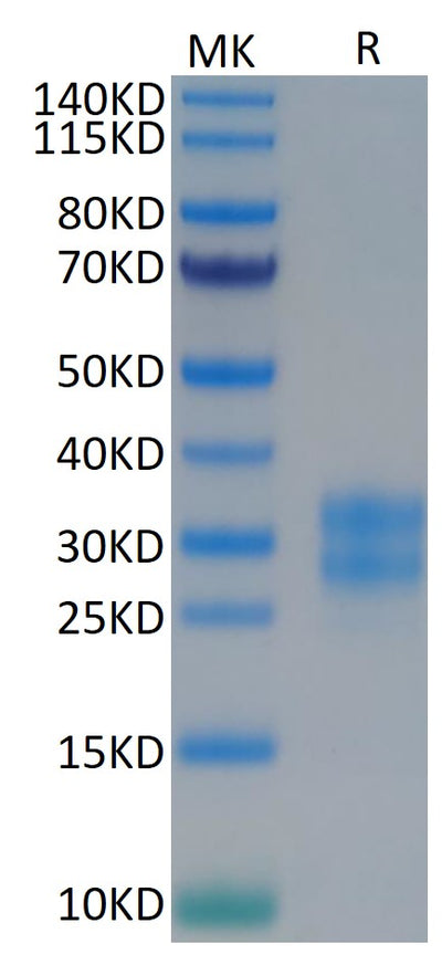 Human M-CSF on Tris-Bis PAGE under reduced conditions. The purity is greater than 95%.Recombinant Human M-CSF/CSF-1 Protein, Active